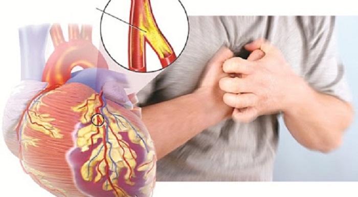 Đau xương ức kèm theo các triệu chứng liên quan đến bệnh lý về tim mạch hay bệnh lý phổi đều rất nguy hiểm